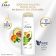 Dove Ultra Care Saç Bakım Şampuanı Dökülme Karşıtı Bakım Avokado Özü 400 ml